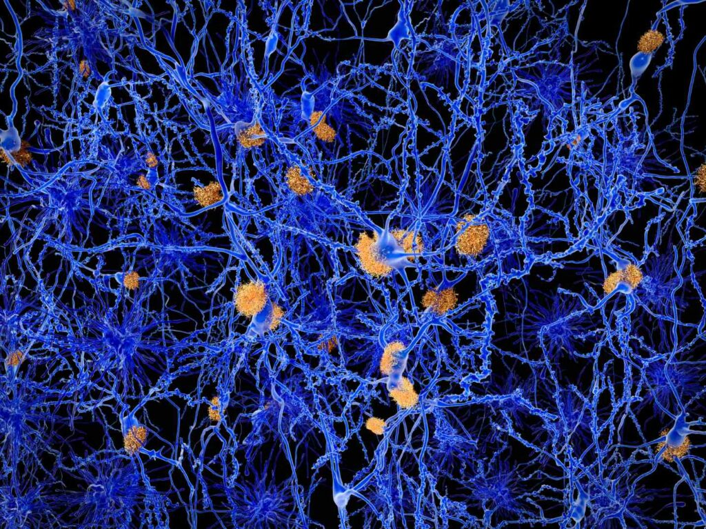 Neurons Thumb 2 637586787554315783 8bpUG0